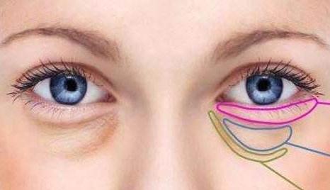 眼袋的形成原因？有哪些方法能有的去除？