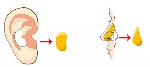 做的耳軟骨墊鼻尖萬一被撞歪了可以修復嗎?怎么修復？