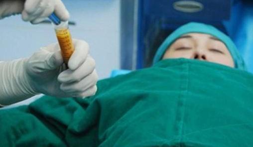 在吸脂豐胸術(shù)前，你需要要了解這些事實！