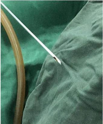 做完腰腹部吸脂之后，皮膚會(huì)不會(huì)變得松弛下垂？