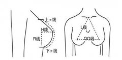 假體隆胸10個(gè)人有9個(gè)做完后悔？后遺癥這么恐怖