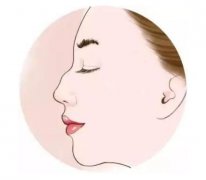 盡管駝峰鼻矯正不是什么大手術(shù)，但是還是得說