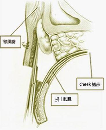 上眼瞼下垂必須要做上瞼提肌手術(shù)嗎？果咋樣？