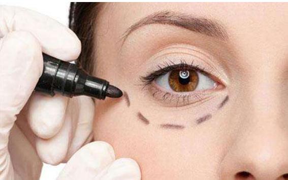 遺傳性眼袋應(yīng)該怎樣有去除？?jī)?nèi)切和外切了解一下~