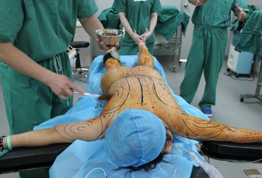 想要擁有身材，全身吸脂手術的危害性大不大？