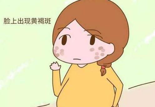 妊娠斑和黃褐斑兩者之間有何區(qū)別？看完就知道了！