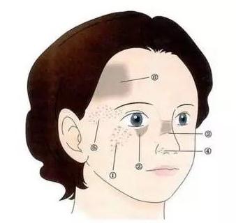 做激光祛斑手術(shù)的時(shí)候，為什么會(huì)有一股燒焦的味道？