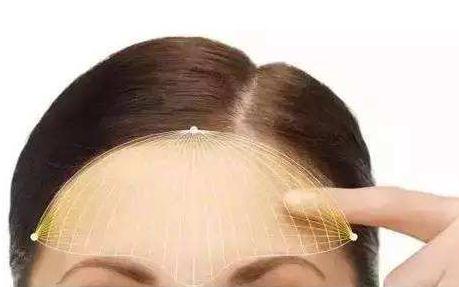 有的人做完自體脂肪填充額頭之后像壽星，原因在這里！