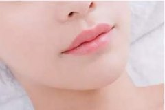 還在猶豫要不要做雙下巴吸脂？你在擔(dān)心后遺癥嗎？