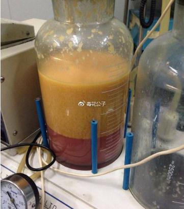 大腿內(nèi)側(cè)吸脂果圖_優(yōu)勢_恢復(fù)注意事項(xiàng)