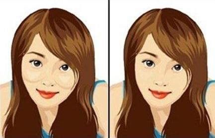 怎么磨顴骨？原來手術(shù)的過程是這樣的！