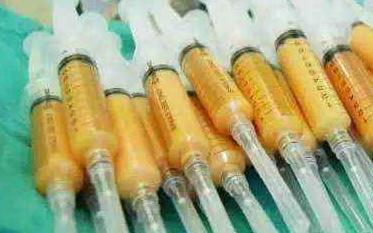 聽(tīng)說(shuō)*********脂肪隆鼻成活率很高，忍不住去體驗(yàn)了一下……