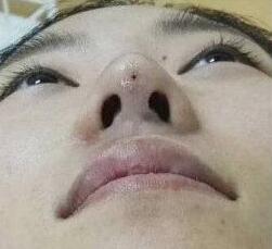 做************一般多少錢？