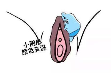 深圳陰唇漂紅多少錢(qián)？深圳哪家醫(yī)院技術(shù)好？