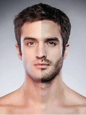 種植鬢角手術(shù)維持多久？