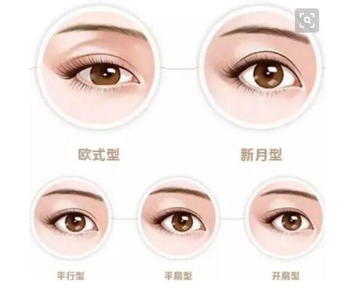 歐式平行雙眼皮大概有多寬?