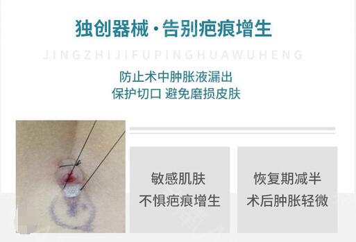 陳江庭醫(yī)生吸脂的獨(dú)特技術(shù)