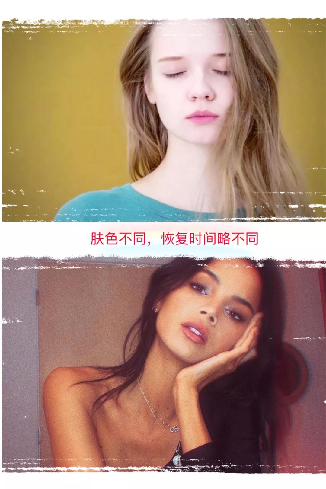 開(kāi)眼角恢復(fù)速度與皮膚顏色相關(guān)，黑皮膚or白皮?