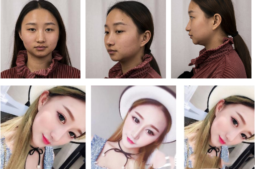 上海華美眼部綜合好不好？