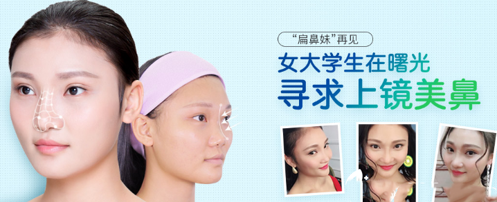 蔣思軍鼻部手術(shù)隆鼻案例對(duì)比圖：