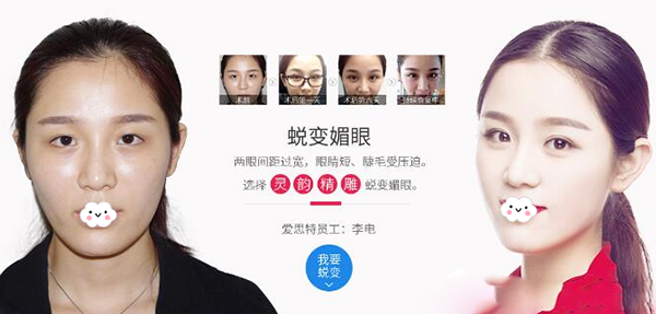 珠海愛思特靈韻大眼術案例