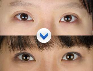 醫(yī)生點(diǎn)評(píng)