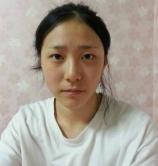 硅膠隆鼻術(shù)后