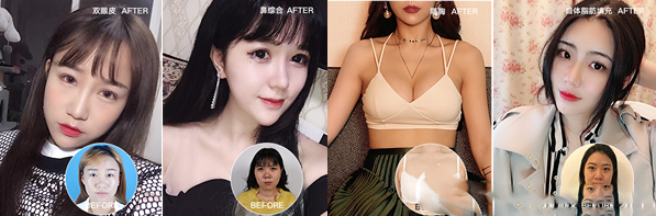 成都潤(rùn)美玉光巖整形美容醫(yī)院案例分析