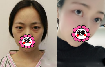 北京歐美拆袋案