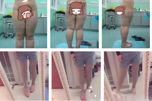 劉晉勝醫(yī)生的案例一