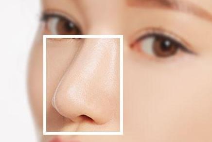 留意！這種是假體隆鼻感染的病癥之一！