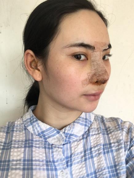 術(shù)后感染處理方法