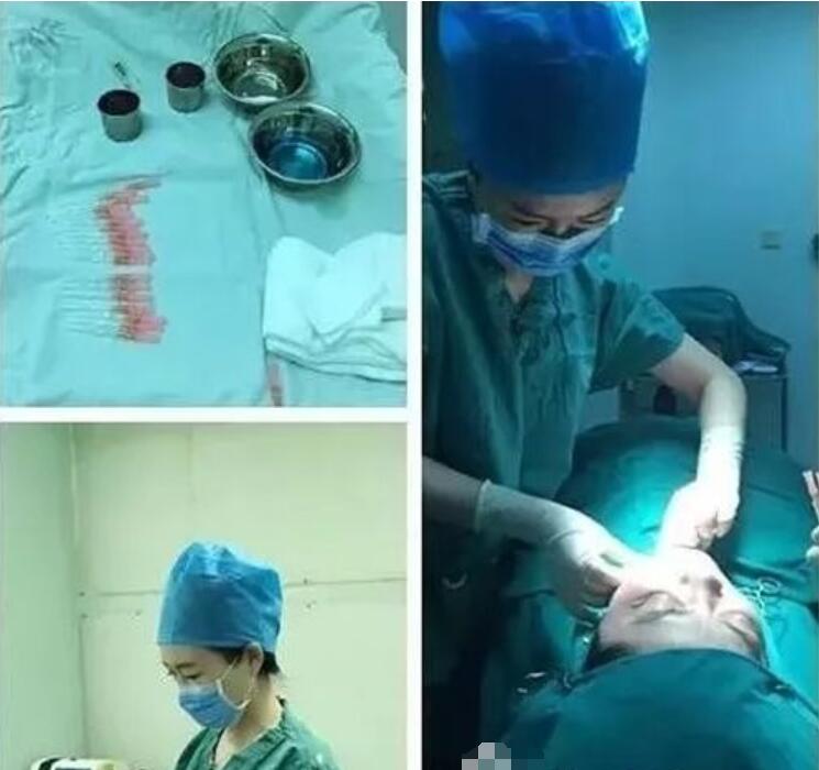 在我們進入正題之前，講一下為什么面部提升術如此受歡迎?