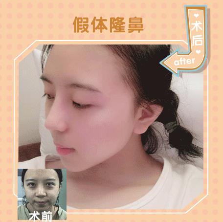 醫(yī)生點(diǎn)評(píng)