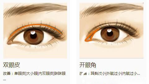 長(zhǎng)春馬麗眼科整形外科