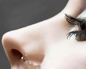 長(zhǎng)春馬麗隆鼻手術(shù)