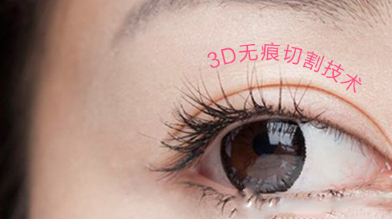 　西安美立方醫(yī)療美容醫(yī)院雙眼皮怎么樣