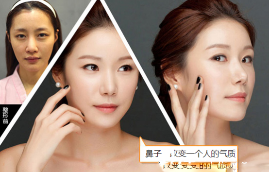 眼部手術(shù)征眼部手術(shù)征