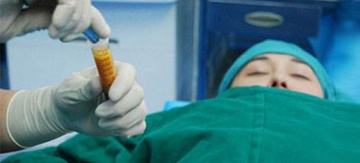 脂肪填充后的針眼疤痕，該怎樣清除？