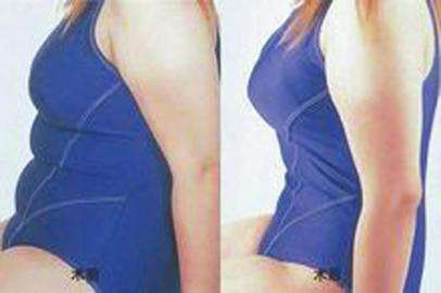 腰腹部環(huán)吸+大腿吸脂手術，讓人體會截然不同的你~