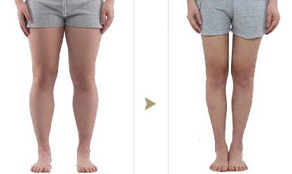 大腿吸脂手術(shù)需要多久？全部手術(shù)調(diào)節(jié)流程方法步驟