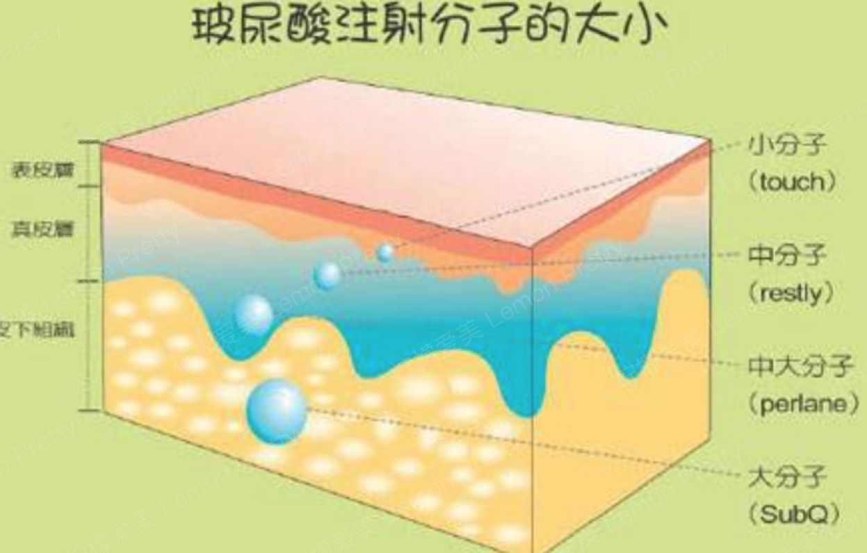 給你們瞧瞧玻尿酸注射的不良反應，看完你還敢反復注射？