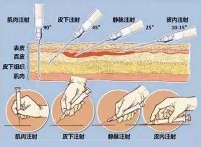 給你們瞧瞧玻尿酸注射的不良反應，看完你還敢反復注射？