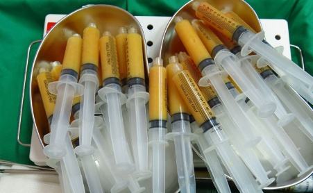 2019年腰部吸脂減肥價錢明細表，附吸脂圖