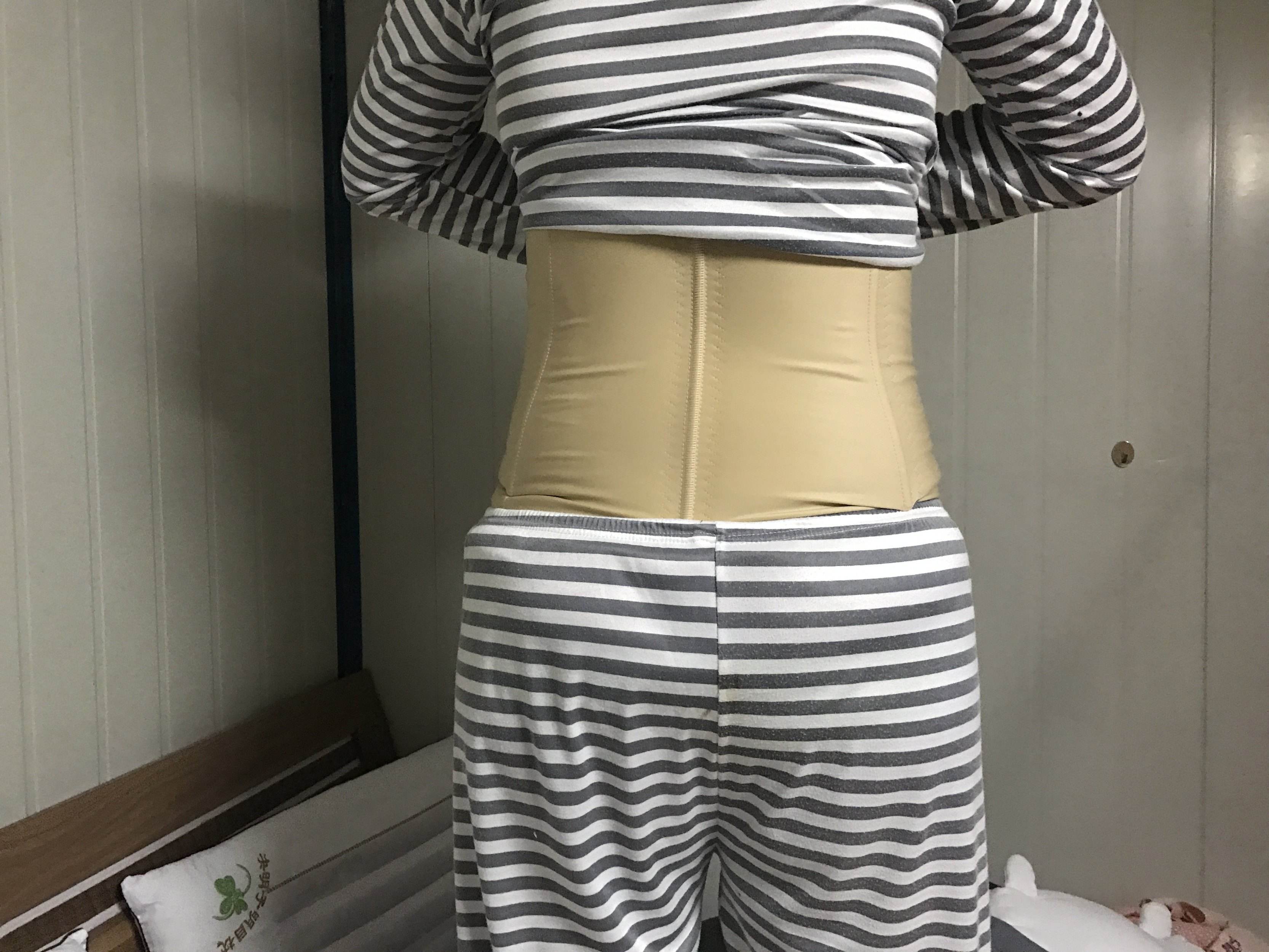 2019年腰部吸脂減肥價錢明細表，附吸脂圖