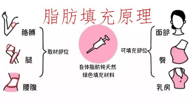 做了脂肪填充過后，是否會迅速就吸收掉？