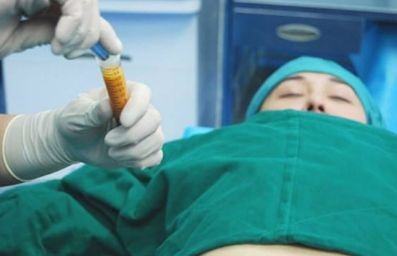 做抽脂手術(shù)失敗的幾率大不大？副作用有哪些？