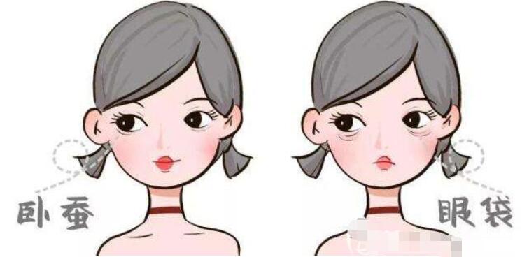 臥蠶和眼袋的區(qū)別