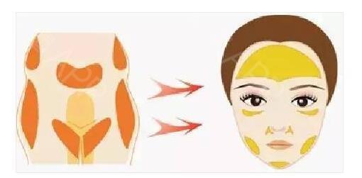 做完脂肪填充面部后擔(dān)心終成豬頭？消腫小妙招~