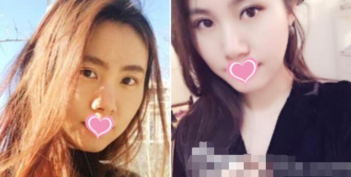 北京伊美爾醫(yī)院案例圖